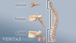 Adult-Cervical-Spine-anatomy-size-comparison